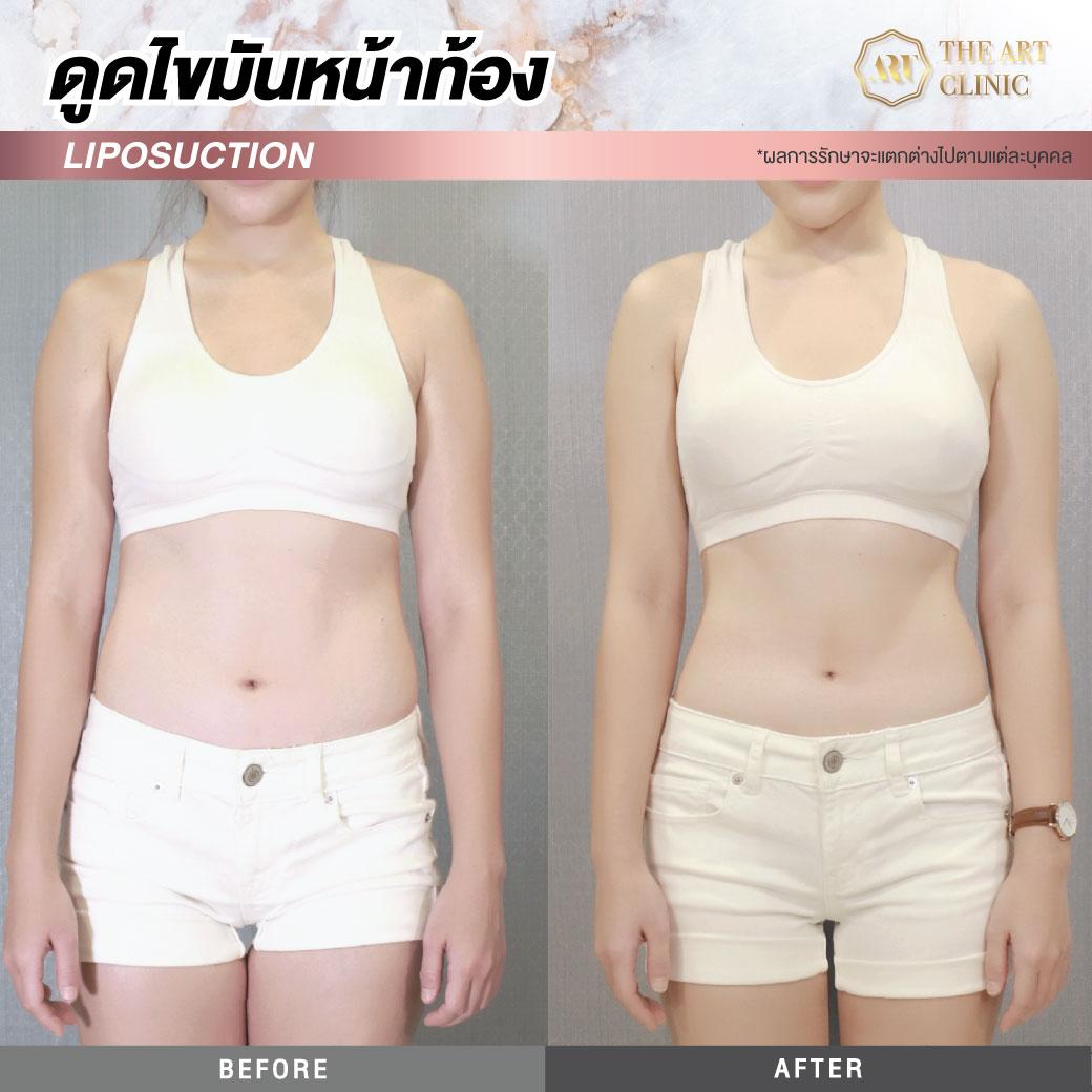 product-2